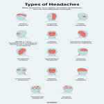 Types of headache.  copyright to Healthline.
